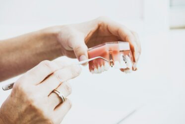 Model of Dental Implant